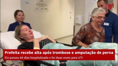 Prefeita que teve perna amputada após trombose recebe alta depois de 64 dias hospitalizada em SC