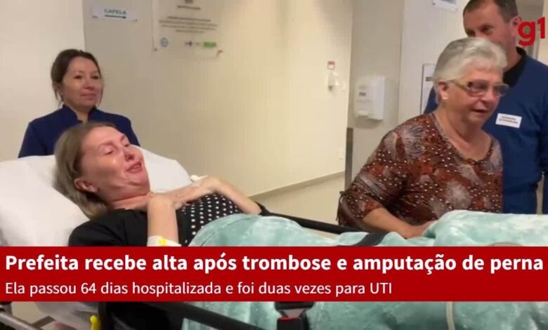 Prefeita que teve perna amputada após trombose recebe alta depois de 64 dias hospitalizada em SC